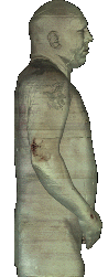 **Side View**